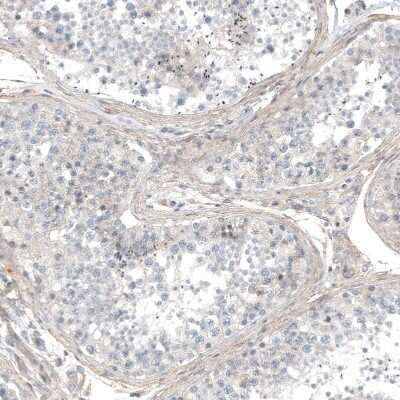 Immunohistochemistry-Paraffin: Hornerin Antibody [NBP1-80807] - Staining of human testis shows weak positivity in peritubular myoid cells.