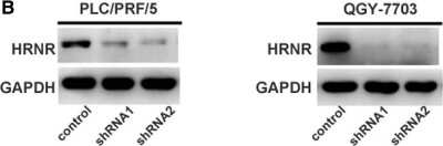 <b>Genetic Strategies Validation. </b>Western Blot: Hornerin Antibody [NBP1-80807] - Hornerin expression in HCC cell lines. RNR shRNAs inhibited the expression of Hornerin in PLC/PRF/5 and QGY-7703 cells Image collected and cropped by CiteAb from the following publication (//bmccancer.biomedcentral.com/articles/10.1186/s12885-018-4719-5), licensed under a CC-BY license.