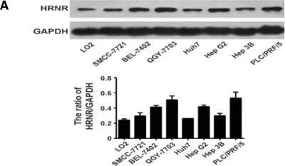 Western Blot: Hornerin Antibody [NBP1-80807] - Hornerin expression in HCC cell lines. Western blot analysis of Hornerin expression levels in a panel of HCC cell lines. Image collected and cropped by CiteAb from the following publication (//bmccancer.biomedcentral.com/articles/10.1186/s12885-018-4719-5), licensed under a CC-BY license.