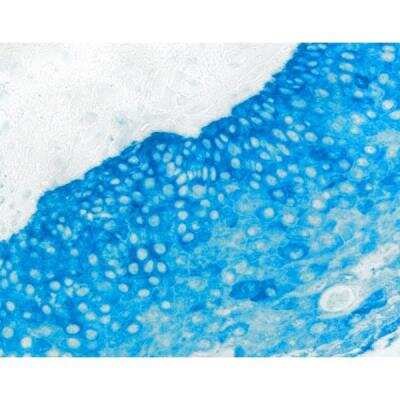 Immunohistochemistry: Horse anti-Mouse IgG ImmPRESS(TM) Secondary Antibody [AP Polymer] [MP-5402-NB] - Tonsil: Cytokeratin AE1/AE3 (m), ImmPRESS-AP anti-mouse Ig, Vector Blue (blue)