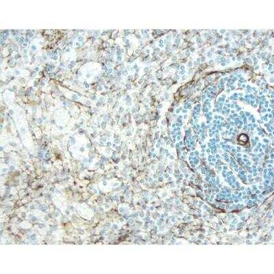 Immunohistochemistry: Horse anti-Mouse IgG ImmPRESS(TM) Secondary Antibody [HRP Polymer] [MP-7422-NB] - Rat Spleen: Desmin (m), ImmPRESS Anti-Mouse Ig Kit (Rat Adsorbed), DAB (brown) Substrate Kit. Hematoxylin QS (blue) counterstain.