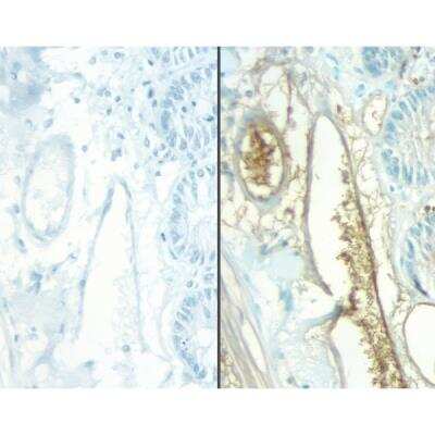 Immunohistochemistry: Horse anti-Mouse IgG ImmPRESS(TM) Secondary Antibody [HRP Polymer] [MP-7422-NB] - No Primary negative controls of rat intestine stained with a rat adsorbed or non-rat adsorbed ImmPRESS Anti-Mouse Ig Kit. ImmPRESS Anti-Mouse Ig Kit (Rat Adsorbed), left, ImmPRESS Anti-Mouse Ig (non-rat adsorbed), right, DAB (brown) Substrate Kit. 