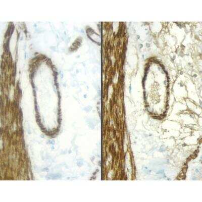 Immunohistochemistry: Horse anti-Mouse IgG ImmPRESS(TM) Secondary Antibody [HRP Polymer] [MP-7422-NB] - Sections of rat intestine stained with a mouse antibody to Desmin and detected with a rat adsorbed or non-rat adsorbed ImmPRESS Anti-Mouse Ig Kit: ImmPRESS Anti-Mouse Ig Kit (Rat Adsorbed), left, ImmPRESS Anti-Mouse Ig (non-rat adsorbed), right; DAB (brown)