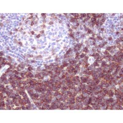 Immunohistochemistry: Horse anti-Mouse, Rabbit IgG ImmPRESS(TM) Universal Secondary Antibody [HRP Polymer] [MP-7500-NB]