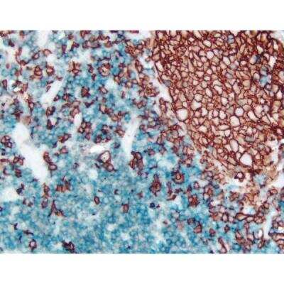 Immunohistochemistry: Horse anti-Mouse, Rabbit IgG ImmPRESS(TM) Universal Secondary Antibody [HRP Polymer] [MP-7500-NB] - Tonsil (double label): CD3 (m), VECTASTAIN Universal ABC-AP Kit, Vector Blue substrate (blue); CD20 (m), ImmPRESS Universal Reagent, Vector NovaRED substrate (red).