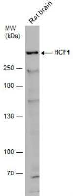 Western Blot: Host Cell Factor 1/HCFC1 Antibody [NBP2-16786] - Rat tissue extract (50 ug) was separated by 5% SDS-PAGE, and the membrane was blotted with HCF1 antibody [N1], N-term  diluted at 1:500. The HRP-conjugated anti-rabbit IgG antibody (NBP2-19301) was used to detect the primary antibody.