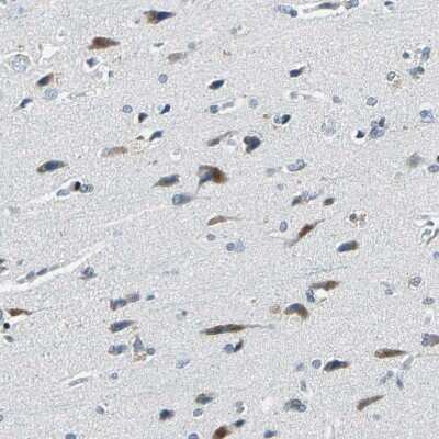 Immunohistochemistry-Paraffin: Host cell factor C2 Antibody [NBP1-92004] - Staining of human Cerebral cortex shows moderate cytoplasmic positivity in neuronal cells.