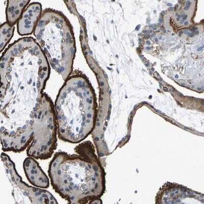 Immunohistochemistry-Paraffin: Host cell factor C2 Antibody [NBP1-92004] - Staining of human Placenta shows moderate cytoplasmic positivity in trophoblastic cells.