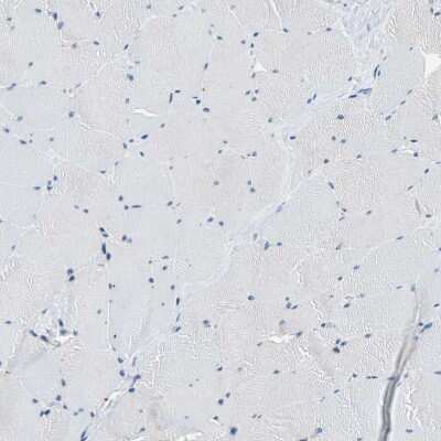 Immunohistochemistry-Paraffin: Host cell factor C2 Antibody [NBP1-92004] - Staining of human Skeletal muscle shows no cytoplasmic positivity in myocytes.