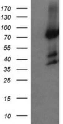 Western Blot: Host cell factor C2 Antibody (OTI5H9) [NBP2-45733] - Analysis of HEK293T cells were transfected with the pCMV6-ENTRY control (Left lane) or pCMV6-ENTRY Host cell factor C2.