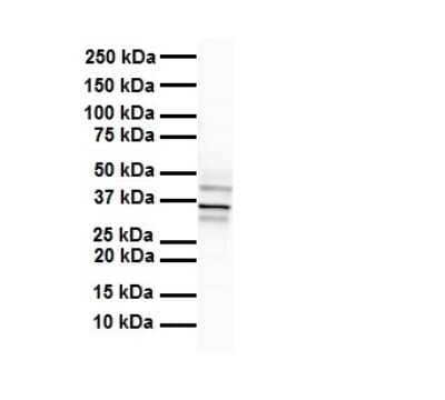 Western Blot: Hoxb3 Antibody [NBP3-09363] - Western blot analysis of Hoxb3 in Human liver. Antibody dilution at 1 ug/mL