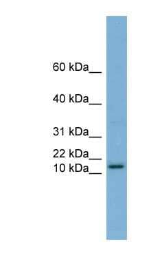 Western Blot: Hrk Antibody [NBP1-59447] - Human Thymus lysate, concentration 0.2-1 ug/ml.