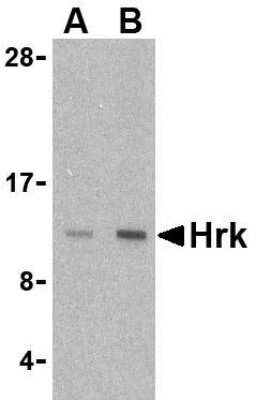 Western Blot: Hrk Antibody [NBP1-76414] - Mouse pancreas tissue lysate with Hrk antibody at (A) 2.5 and (B) 5 u/mL.