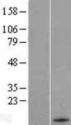 Western Blot: Hrk Overexpression Lysate (Adult Normal) [NBL1-11709] Left-Empty vector transfected control cell lysate (HEK293 cell lysate); Right -Over-expression Lysate for Hrk.