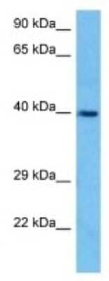 Western Blot Hsd3b5 Antibody