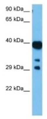 Western Blot: Hsd3b6 Antibody [NBP3-10130] - Western blot analysis of Hsd3b6 in Mouse Pancreas lysates. Antibody dilution at 1ug/ml