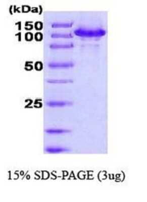 SDS-Page: Recombinant Human HSPH1/HSP105 Protein [NBC1-18374] - HSP105a, 100.9kDa (894aa) with a purity of 90% by SDS - PAGE