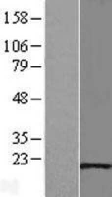 Western Blot: Hsp20 Overexpression Lysate (Adult Normal) [NBL1-11759] Left-Empty vector transfected control cell lysate (HEK293 cell lysate); Right -Over-expression Lysate for Hsp20.