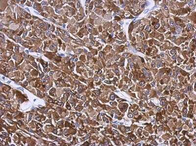Immunohistochemistry-Paraffin: Hsp27 Antibody [NBP2-16891] - Immunohistochemical analysis of paraffin-embedded U87 xenograft, using antibody at 1:500 dilution.