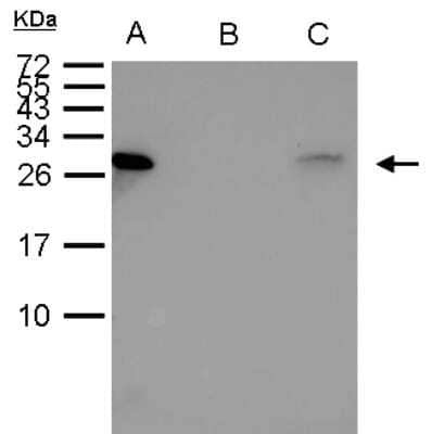Immunoprecipitation: Hsp27 Antibody [NBP2-16891] - Sample: 1000 ug HeLa whole cell lysate/extract A. 40 ug HeLa whole cell lysate/extract B. Control with 2. 5 ug of preimmune rabbit IgG C. Immunoprecipitation of HSP27 protein by 2. 5 ug of HSP27 15% SDS-PAGE The immunoprecipitated HSP27 protein was detected by HSP27 antibody diluted at 1:1000.  anti-rabbit IgG was used as a secondary reagent.