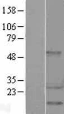 Western Blot HSP27 Overexpression Lysate