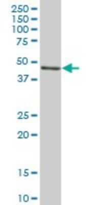 Western Blot: Hsp47 Antibody [H00000871-B01P] - Analysis of SERPINH1 expression in human pancreas.