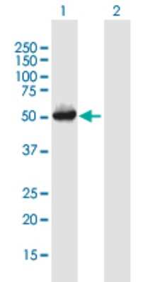 Western Blot: Hsp47 Antibody [H00000871-B01P] - Analysis of SERPINH1 expression in transfected 293T cell line by SERPINH1 polyclonal antibody.  Lane 1: SERPINH1 transfected lysate(45.98 KDa). Lane 2: Non-transfected lysate.