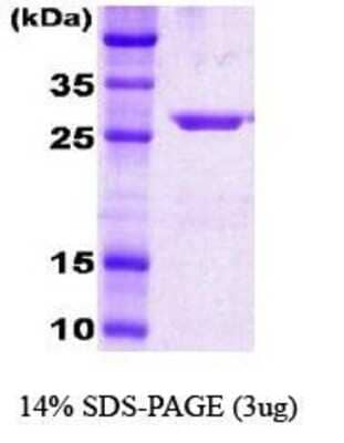 SDS-Page: Hsp70 Protein [NBC1-18359] - Dna K, 27.7kDa (255aa) with a purity of 95% by SDS - PAGE