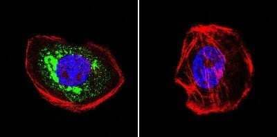 Immunocytochemistry/Immunofluorescence: Hsp70 interacting protein HIP Antibody (2G6) [NB120-2813] - A431 cells were grown on chamber slides and fixed with formaldehyde prior to staining. Cells were probed without (control) or with a HIP monoclonal antibody at a dilution of 1:100 overnight at 4 C, washed with PBS and incubated with a DyLight-488 conjugated secondary antibody. HIP staining (green), F-Actin staining with Phalloidin (red) and nuclei with DAPI (blue) is shown. Images were taken at 60X magnification.