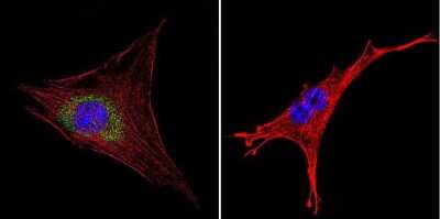 Immunocytochemistry/Immunofluorescence: Hsp70 interacting protein HIP Antibody (2G6) [NB120-2813] - Analysis of HIP in NIH-3T3 cells. Cells were grown on chamber slides and fixed with formaldehyde prior to staining. Cells were probed without (control) or with a HIP monoclonal antibody at a dilution of 1:200 overnight at 4C, washed with PBS and incubated with a DyLight-488 conjugated secondary antibody. HIP staining (green), F-Actin staining with Phalloidin (red) and nuclei with DAPI (blue) is shown. Images were taken at 60X magnification.