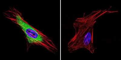 Immunocytochemistry/Immunofluorescence: Hsp70 interacting protein HIP Antibody (2G6) [NB120-2813] - Analysis of HIP in HeLa cells. Cells were grown on chamber slides and fixed with formaldehyde prior to staining. Cells were probed without (control) or with a HIP monoclonal antibody at a dilution of 1:20 overnight at 4C, washed with PBS and incubated with a DyLight-488 conjugated secondary antibody. HIP staining (green), F-Actin staining with Phalloidin (red) and nuclei with DAPI (blue) is shown. Images were taken at 60X magnification.