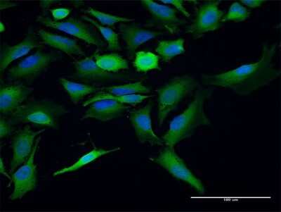 Immunocytochemistry/Immunofluorescence: Hsp70 interacting protein HIP Antibody [H00006767-B01P] - Analysis of purified antibody to ST13 on HeLa cell. (antibody concentration 10 ug/ml)
