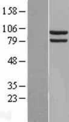 Western Blot: Hsp90A Overexpression Lysate (Adult Normal) [NBL1-11743] Left-Empty vector transfected control cell lysate (HEK293 cell lysate); Right -Over-expression Lysate for Hsp90A.