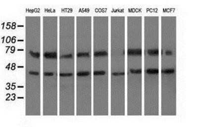 Western Blot: HspA6 Antibody (OTI1H3) - Azide and BSA Free [NBP2-70959] - Analysis of extracts (35ug) from 9 different cell lines by using anti-HspA6 monoclonal antibody.