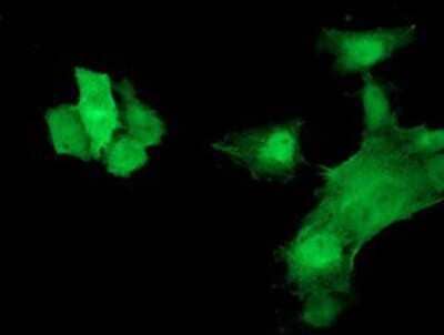 Immunocytochemistry/Immunofluorescence: HspB7 Antibody (1D11) [NBP2-02666] Staining of COS7 cells transiently transfected by pCMV6-ENTRY HspB7.