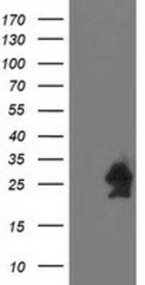 Western Blot: HspB7 Antibody (1D11) [NBP2-02666] - HEK293T cells were transfected with the pCMV6-ENTRY control (Left lane) or pCMV6-ENTRY HspB7 (Right lane) cDNA for 48 hrs and lysed. Equivalent amounts of cell lysates (5 ug per lane) were separated by SDS-PAGE and immunoblotted with anti-HspB7.