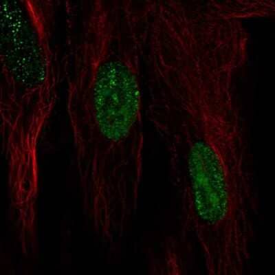 Immunocytochemistry/Immunofluorescence: HspB7 Antibody [NBP1-84334] - Immunofluorescent staining of human cell line BJ shows localization to nucleoplasm.