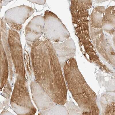 Immunohistochemistry-Paraffin: HspB7 Antibody [NBP1-84334] - Staining of human skeletal muscle shows strong cytoplasmic positivity in myocytes.