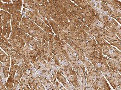 Immunohistochemistry-Paraffin: HspB7 Antibody [NBP2-99273] - Immunochemical staining HspB7 in mouse heart with rabbit polyclonal antibody (1:1000, formalin-fixed paraffin embedded sections).