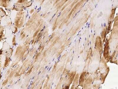 Immunohistochemistry-Paraffin: HspB7 Antibody [NBP2-99273] - Immunochemical staining HspB7 in mouse skeletal muscle with rabbit polyclonal antibody (1:1000, formalin-fixed paraffin embedded sections).