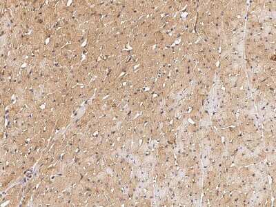 Immunohistochemistry-Paraffin: HspB7 Antibody [NBP2-99273] - Immunochemical staining HspB7 in rat heart with rabbit polyclonal antibody (1:1000, formalin-fixed paraffin embedded sections).