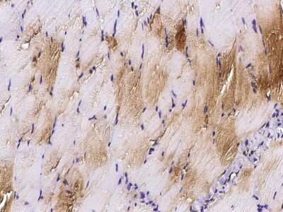 Immunohistochemistry-Paraffin: HspB7 Antibody [NBP2-99273] - Immunochemical staining HspB7 in rat skeletal muscle with rabbit polyclonal antibody (1:1000, formalin-fixed paraffin embedded sections).