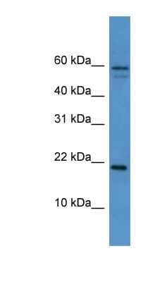 Western Blot: HspB7 Antibody [NBP1-69072] - Mouse Heart lysate, concentration 0.2-1 ug/ml.