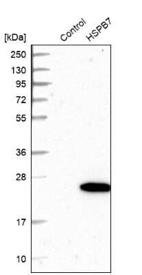 Western Blot: HspB7 Antibody [NBP1-84334] - Analysis in control (vector only transfected HEK293T lysate) and HSPB7 over-expression lysate (Co-expressed with a C-terminal myc-DDK tag (3.1 kDa) in mammalian HEK293T cells).