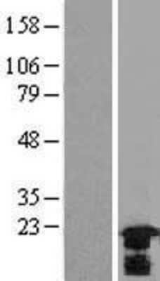 Western Blot HspB7 Overexpression Lysate