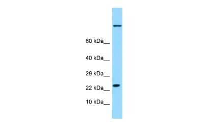 Western Blot: HspB9 Antibody [NBP2-84083] - WB Suggested Anti-HSPB9 Antibody. Titration: 1.0 ug/ml. Positive Control: Fetal Lung