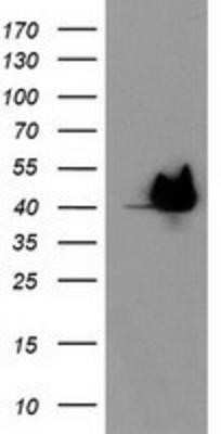 Western Blot: HspBP1 Antibody (OTI1D5) - Azide and BSA Free [NBP2-71761] - HEK293T cells were transfected with the pCMV6-ENTRY control (Left lane) or pCMV6-ENTRY HspBP1 (Right lane) cDNA for 48 hrs and lysed. Equivalent amounts of cell lysates (5 ug per lane) were separated by SDS-PAGE and immunoblotted with anti-HspBP1.