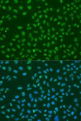 Immunocytochemistry/Immunofluorescence: HuR/ELAVL1 Antibody [NBP3-02947] - Analysis of U2OS cells using HuR/ELAVL1 antibody at dilution of 1:100. Blue: DAPI for nuclear staining.