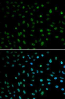 Immunocytochemistry/Immunofluorescence: HuR/ELAVL1 Antibody [NBP3-03449] - Analysis of MCF-7 cells using HuR/ELAVL1 antibody . Blue: DAPI for nuclear staining.