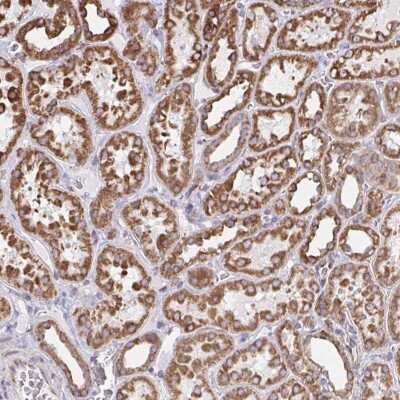 Immunohistochemistry: HuR/ELAVL1 Antibody [NBP2-38548] - Staining of human kidney shows strong cytoplasmic positivity in renal tubules.